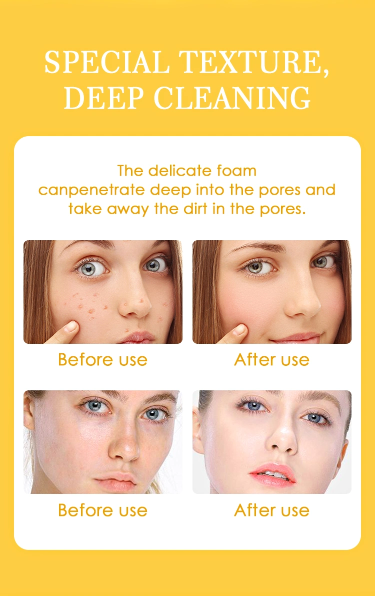 OEM Private Label Skin Care Deeply Cleansing Face Wash Gel Acne Treatment Whitening Turmeric Extract Facial Cleanser